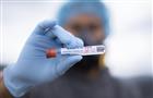 Количество зарегистрированных за пандемию случаев коронавируса в России превысило 9,5 млн