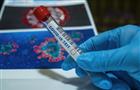 В Роспотребнадзоре заявили о возможном росте заболеваемости коронавирусом после новогодних праздников