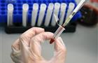 Тольяттинских медиков подозревают в заражении пациентки ВИЧ-инфекцией