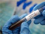 В Самарской области за сутки выявили 63 случая заражения коронавирусом