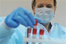 Большинство больных ВИЧ в Самарской области заразились при незащищенном сексе