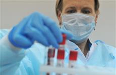 Большинство больных ВИЧ в Самарской области заразились при незащищенном сексе