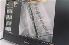 Кировские хирурги провели уникальную операцию при помощи ангиографического комплекса