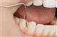 Заболевания пародонта: почему выпадают зубы?